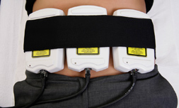 i-lipo inch loss treatments